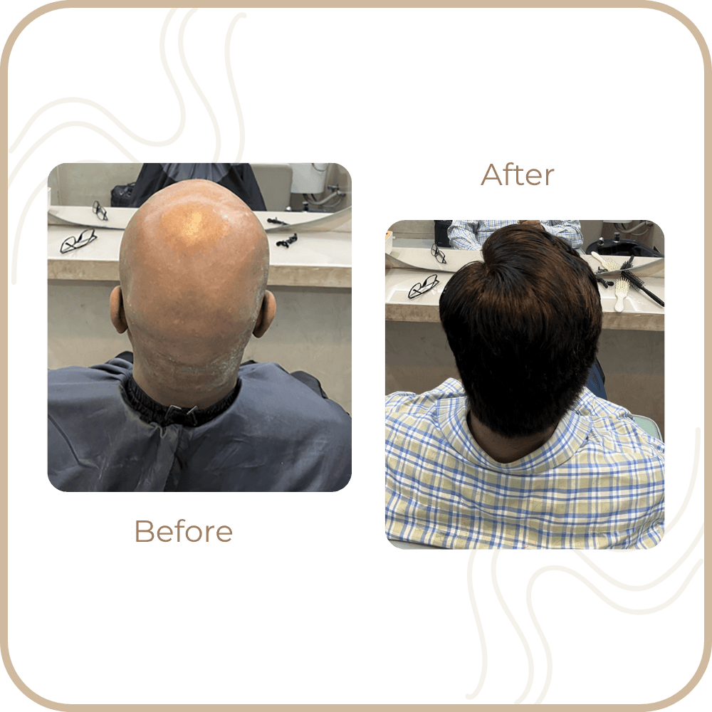 Hair Transformation