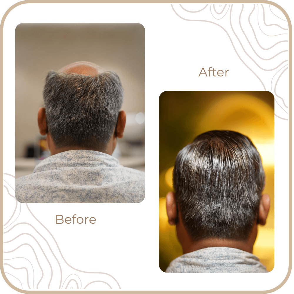 Hair Transformation