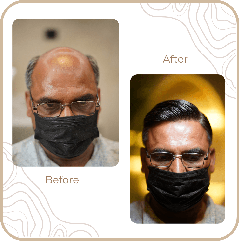 Hair Transformation
