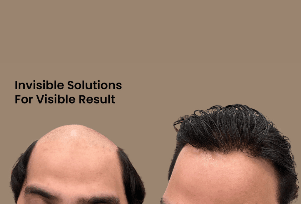 Hair Guidance